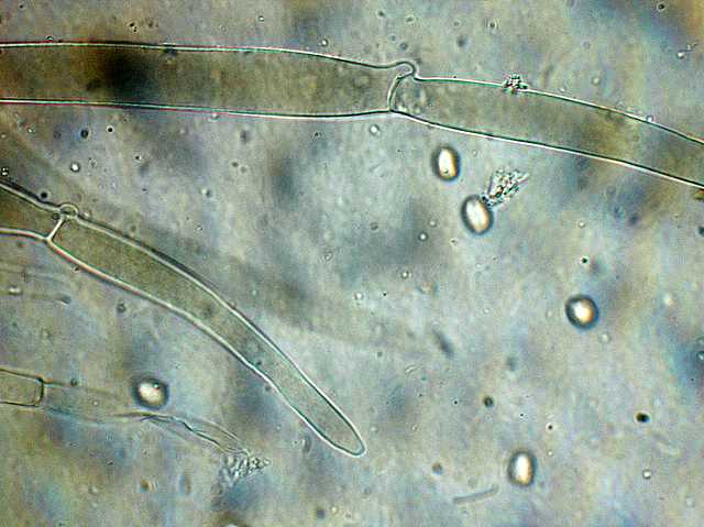 Pluteus   pseudorobertii   M.M. Moser